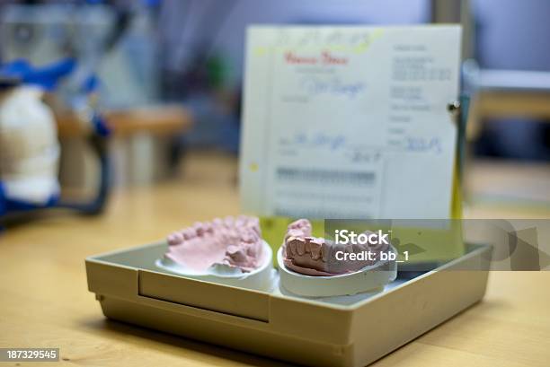 Nowe Zamówienia Implantu Protezy - zdjęcia stockowe i więcej obrazów Dokładność - Dokładność, Fotografika, Gabinet stomatologiczny