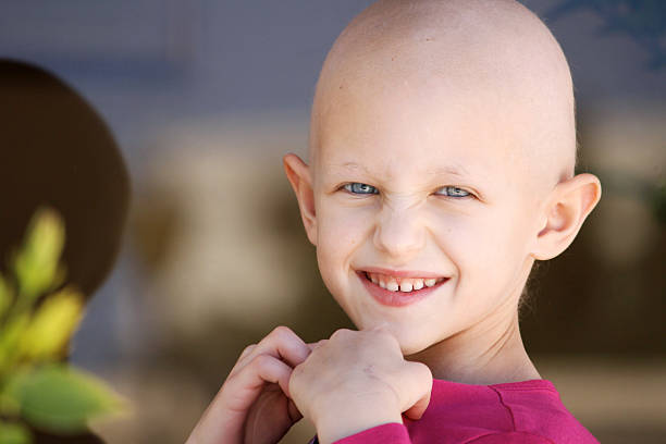 Young girl with hair chemotherapy hair loss stock photo