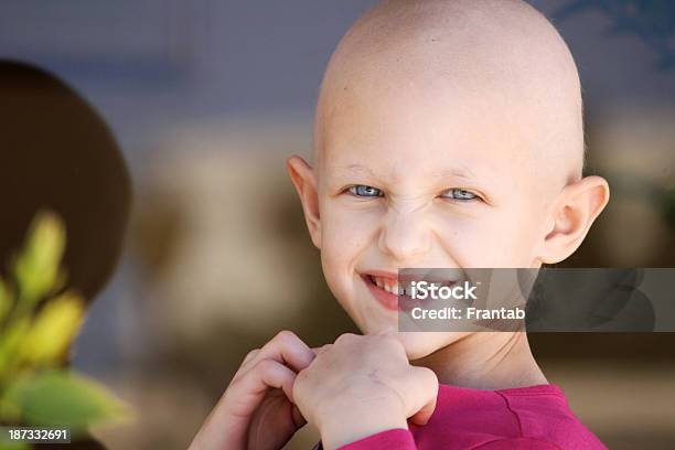 Young Girl With Hair Chemotherapy Hair Loss Stock Photo - Download Image Now - Child, Cancer - Illness, Hair Loss