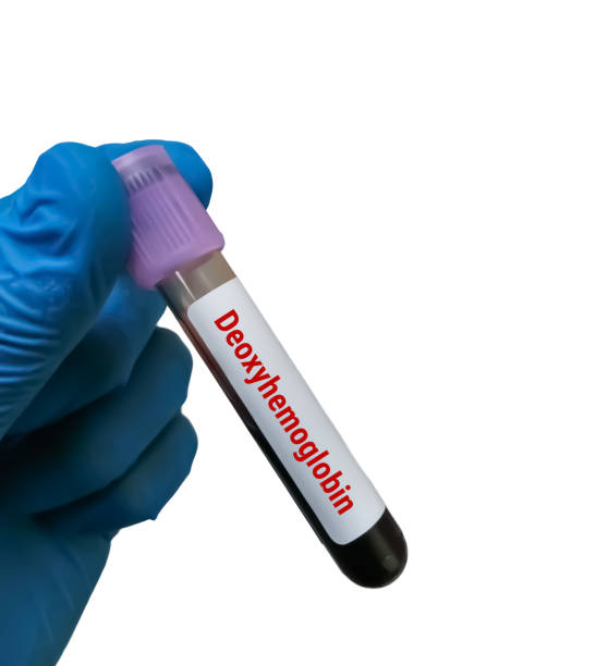 istock Deoxyhemoglobin or Reduced hemoglobin (RHb) test, hemoglobin which is not combined with oxygen 1873839884