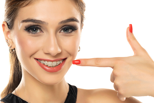 Face of a young smiling beautiful brunette woman pointing on the braces on her teeth, Orthodontic Treatment.