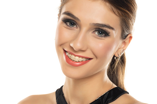 Face of a young smiling beautiful brunette woman with the braces on her teeth, Orthodontic Treatment.