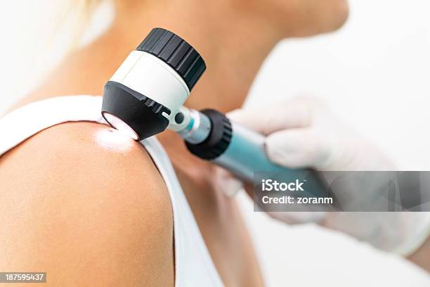 Skin Cancer Stockfoto und mehr Bilder von Dermatologie - Dermatologie, Melanom, Hautkrebs