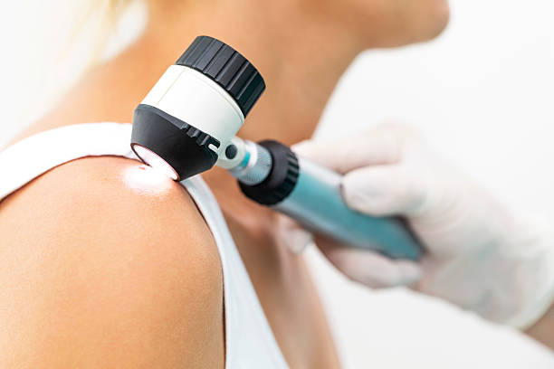 Skin cancer Doctor examining melanoma, using dermatoscope, copy space skin exame stock pictures, royalty-free photos & images