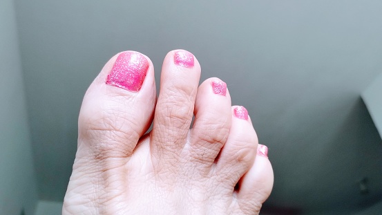 Toenails with pink nail polish