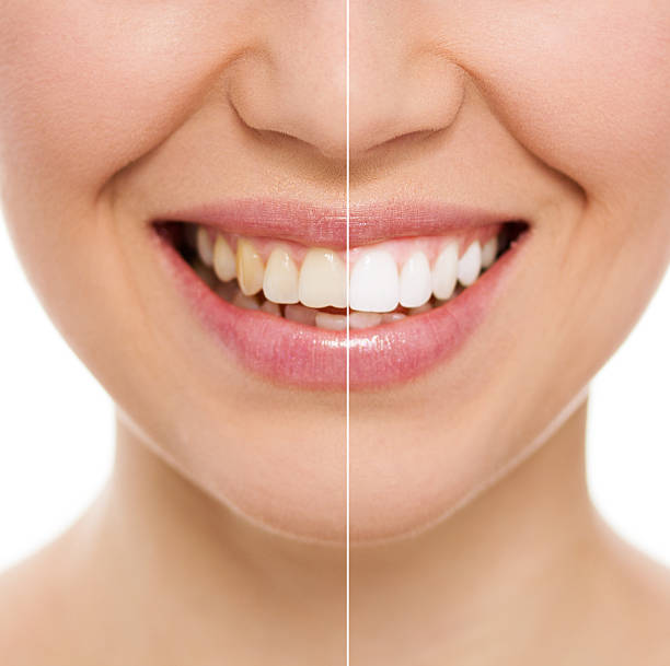 istock Dental care woman 187673890