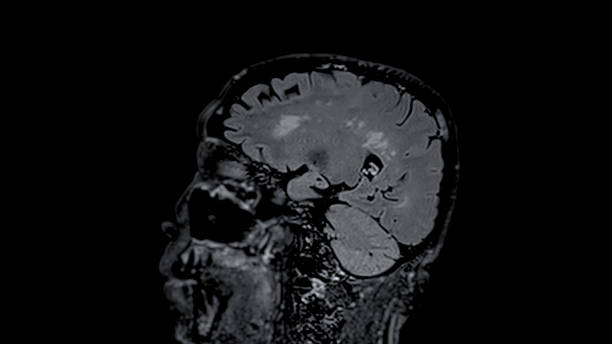 istock MRI brain scans sagittal view offer valuable insights into brain 1876750445