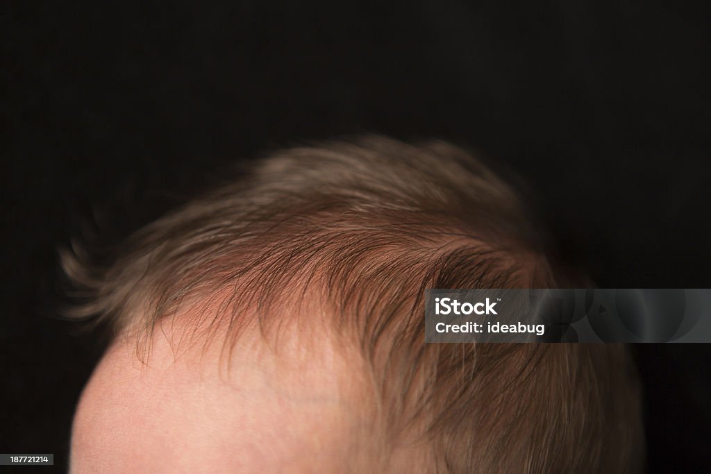 Close Up,Color Image of Newborn's Forehead and Hair Close up, color image of the top part of a newborn's forehead and hair, with a black background. Top Of Head Stock Photo