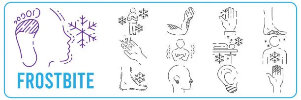 Vector illustration of Frostbite. Symptoms, Line icons set. Vector signs for web graphics