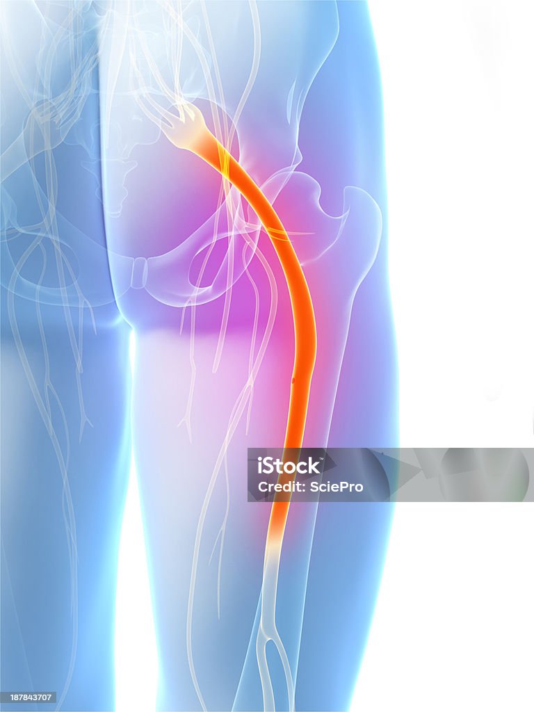 painful sciatic nerve 3d rendered illustration of the sciatic nerve Sciatic Nerve Stock Photo