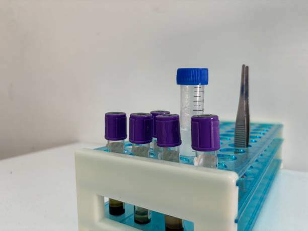 istock Blood Sample Test Tube 1878783363