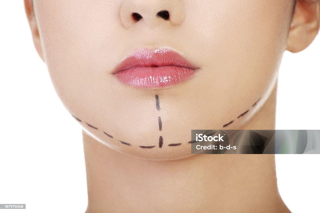 Drawn lines on female's. Facial plastic surgery concept. Drawn lines on female's. Facial plastic surgery concept. Isolated on white. Adult Stock Photo