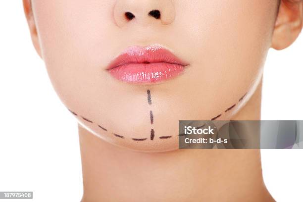 Drawn Lines On Females Facial Plastic Surgery Concept Stock Photo - Download Image Now