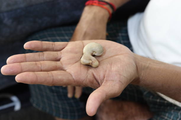 Cashew Seed on Hand . Vadodara - Gujrat -India.
