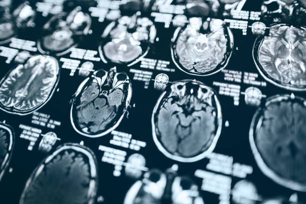 頭部の磁気共鳴スキャン - mri scanner healthcare and medicine medical exam brain ストックフォトと画像