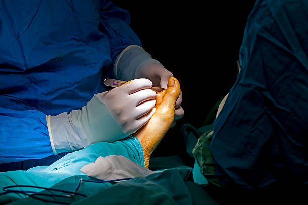 foot chirurgie - podiatrist orthopedic surgeon podiatry surgical equipment photos et images de collection