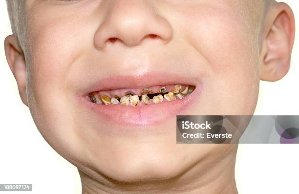 Calfs Teeth Decay Toothache Dental Medicine Stock Photo - Download Image Now - Child, Rotting, Toothbrush