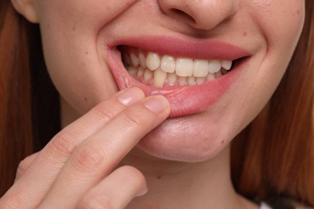 istock Woman showing her clean teeth, closeup view 1885919057