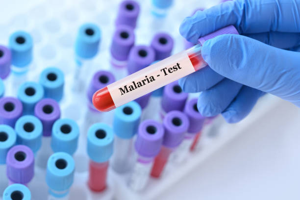 Doctor holding a test blood sample tube with Malaria Ag (Pf,Pv) test on the background of medical test tubes with analyzes Doctor holding a test blood sample tube with Malaria Ag (Pf,Pv) test on the background of medical test tubes with analyzes malaria blood sample stock pictures, royalty-free photos & images