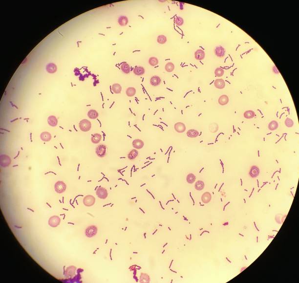 顕微鏡で見た連鎖球菌 - blood cell formation ストックフォトと画像