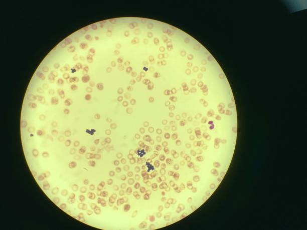 顕微鏡で見たmrsaによる敗血症 - blood cell formation ストックフォトと画像