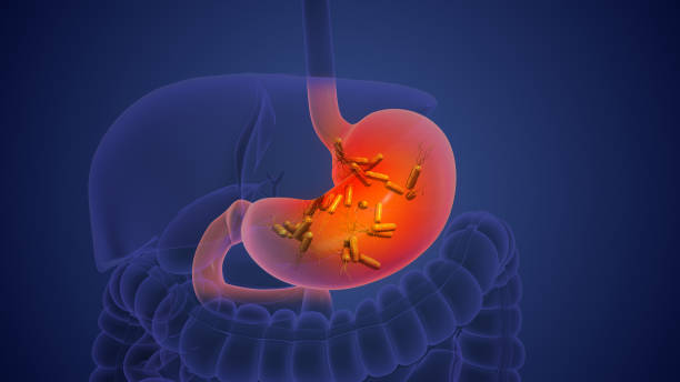 istock Helicobacter pylori causes chronic inflammation and gastric cancer 1891401124