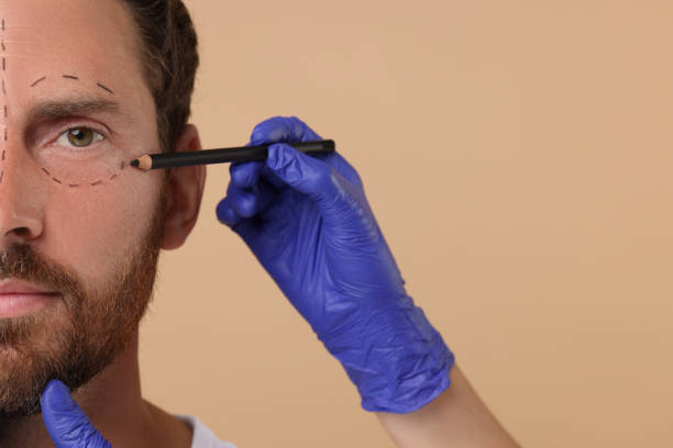 istock Doctor drawing marks on man's face for cosmetic surgery operation against beige background, closeup 1893573828