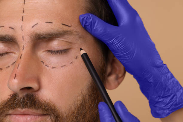 istock Doctor drawing marks on man's face for cosmetic surgery operation against beige background, closeup 1893576318