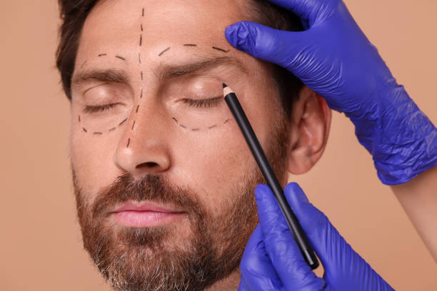 istock Doctor drawing marks on man's face for cosmetic surgery operation against beige background, closeup 1893576410