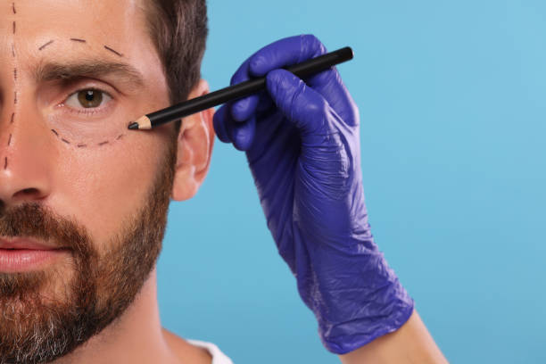 istock Doctor drawing marks on man's face for cosmetic surgery operation against light blue background, closeup 1893576413