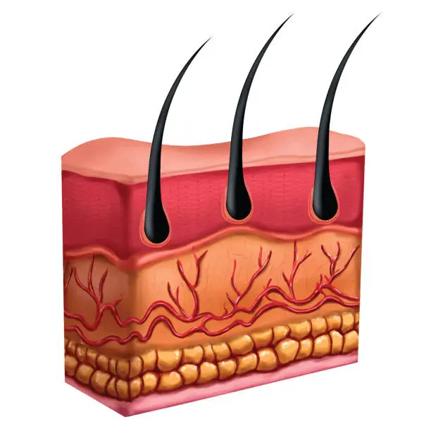 Vector illustration of hair and scalp vector. Active ingredient treatment deep into hair and scalp. skin hair vector. a healthy scalp and the scalp is affected by inflammation and dandruff.