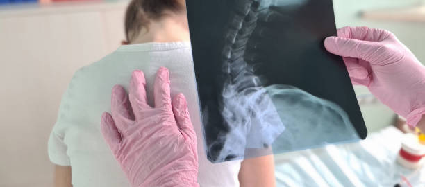 istock Pediatrician doctor examines x-ray of child spinal deformity 1897274947