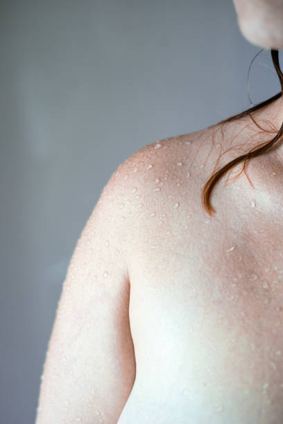 istock Freckled Shoulder in Shower's Embrace 1901633084