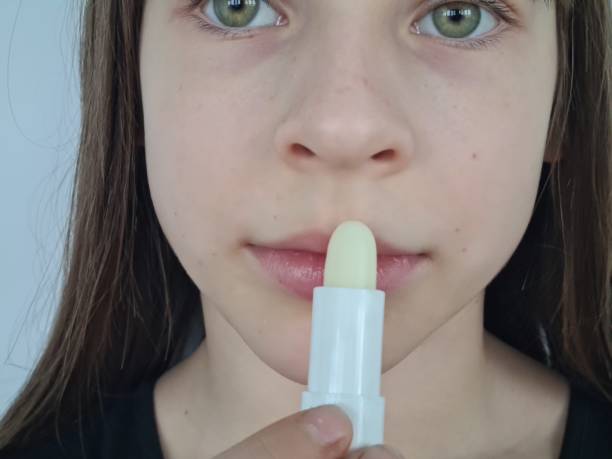 Chapped and dry lips moisturizing lip balm promo