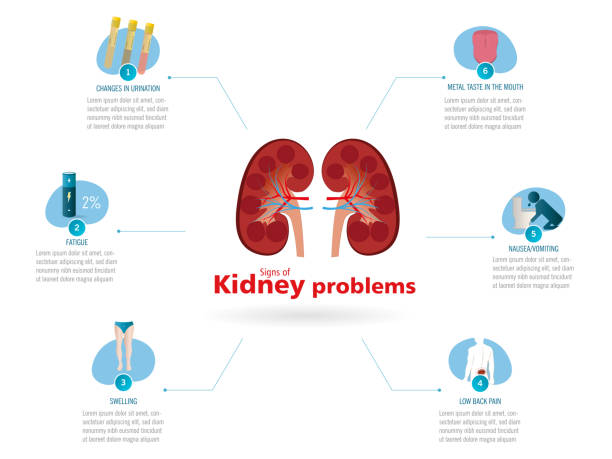 Infographic about the main signs that indicate kidney problems Infographic about the main signs that indicate kidney problems, in the center a kidney and its parts surrounded by the main signs, flat design on white background. bedpan stock illustrations
