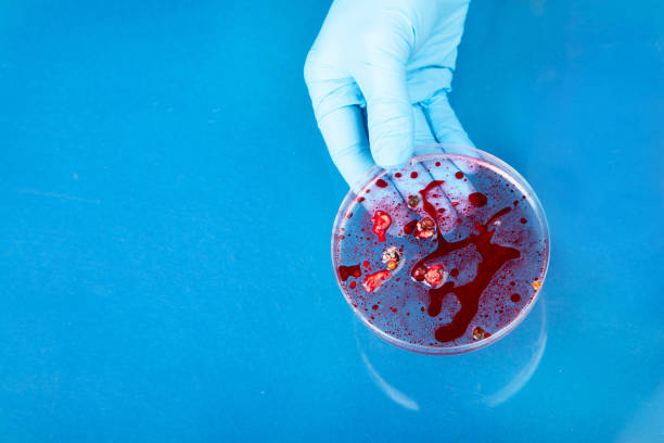 Hand in blue glove holding  petri dish with bacterium . Microbiology sience. Top  view.
