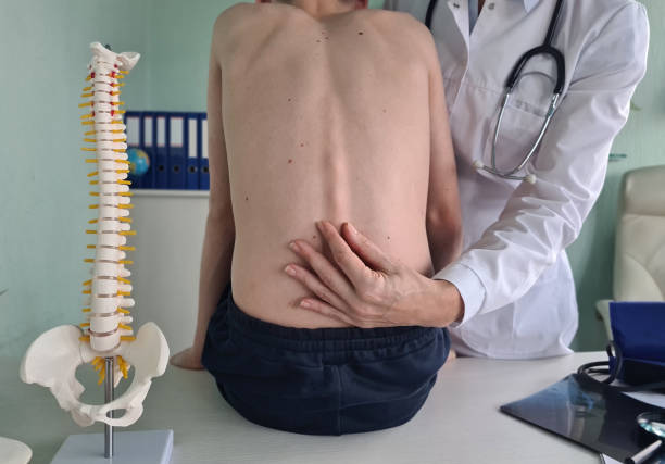 Orthopedist examines spine and posture and spinal deformities of teenage patient Orthopedist examines spine and posture and spinal deformities of teenage patient. Teenage boy visits pediatrician for annual checkup kyphosis stock pictures, royalty-free photos & images
