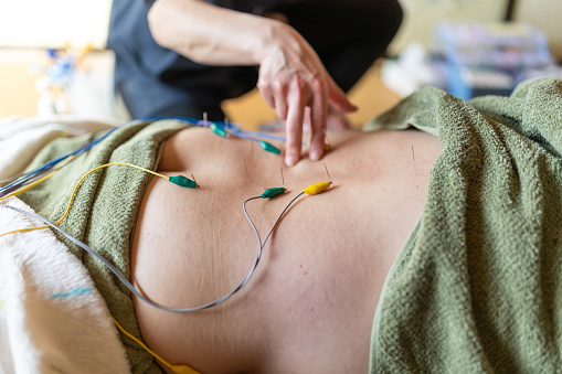 A therapist gives acupuncture with electric wires and clips attached to the acupuncture pins to another woman in a Japanese domestic room.