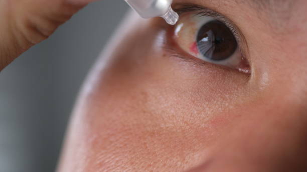 istock A man giving eye drops to the bleeding eye. 1908298180