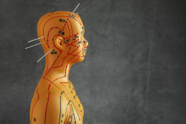 istock Acupuncture - alternative medicine. Human model with needles in head against dark grey background, space for text 1908689199