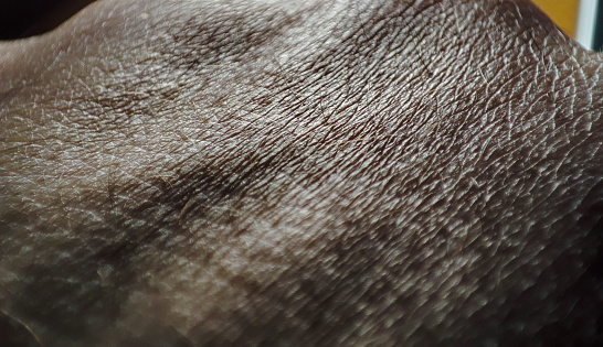 High-res macro shot capturing the unique texture of human skin, detail emphasized.