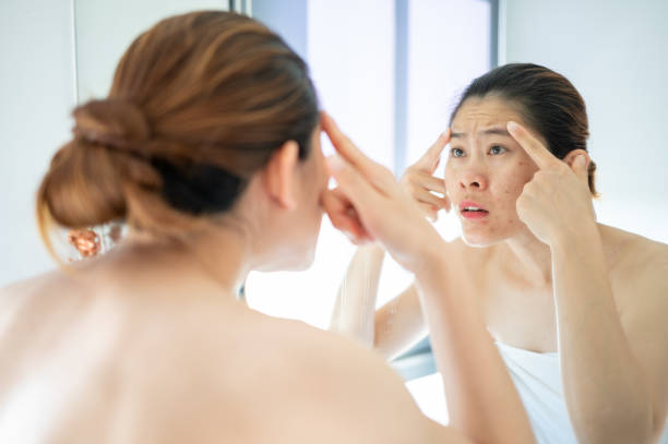 istock Asian woman having stress after looking her face in mirror. 1918836437