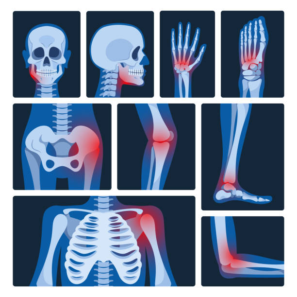 istock X-ray Pictures Vector Set. Medical Images Revealing Internal Structures Of The Body. They Help Diagnose Conditions 1918978036