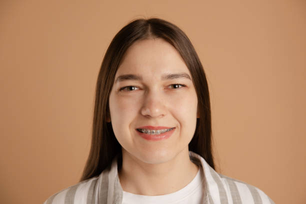 istock calm smiling girl with braces look at camera on studio beige background 1919203801