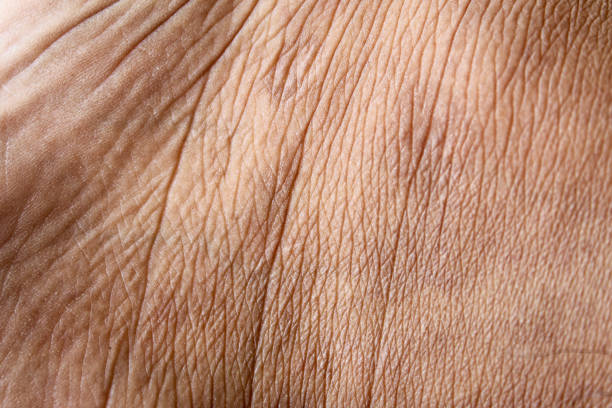 istock Wrinkled skin texture on men's legs 1920800810