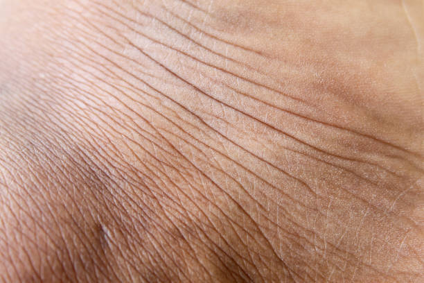 istock Wrinkled skin texture on men's legs 1920800846