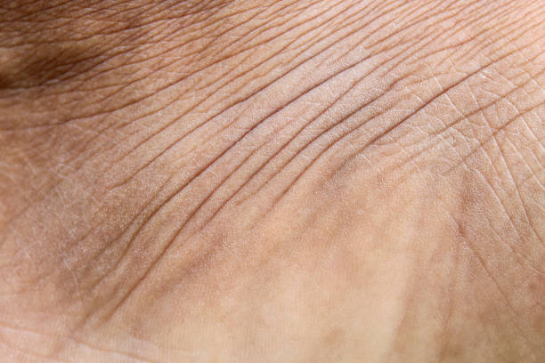 istock Wrinkled skin texture on men's legs 1920883598