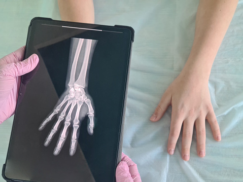 Doctor holding tablet with x-ray of child patient hand. Bruise of the hand, dislocation, fracture, sprained arms in children and adolescents