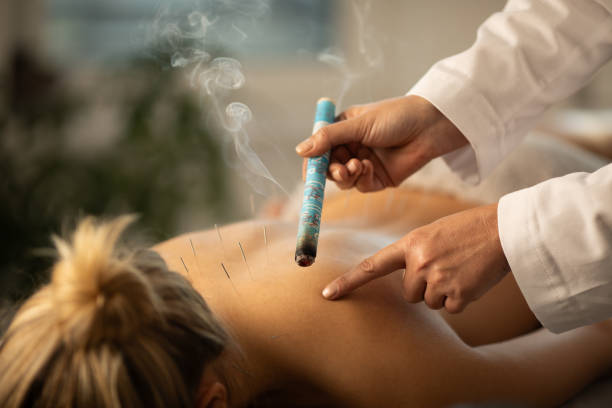 Woman lying down on a acupuncture bed, getting a treatment with acupuncture needles and moxa Woman is lying on her stomach on an acupuncture bed, getting a treatment with acupuncture needles and moxa. She looks relaxed, enjoying the treatment. acupuncture model stock pictures, royalty-free photos & images