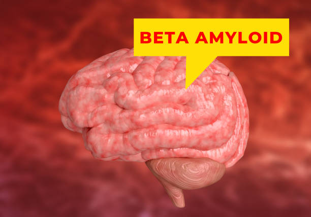 os beta-amiloide são peptídeos com 36-43 aminoácidos e o principal constituinte das placas observadas no cérebro de pacientes com doença de alzheimer - neurologic - fotografias e filmes do acervo